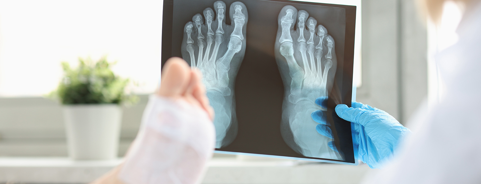 Ärztin betrachtet Röntgenbild der Füße